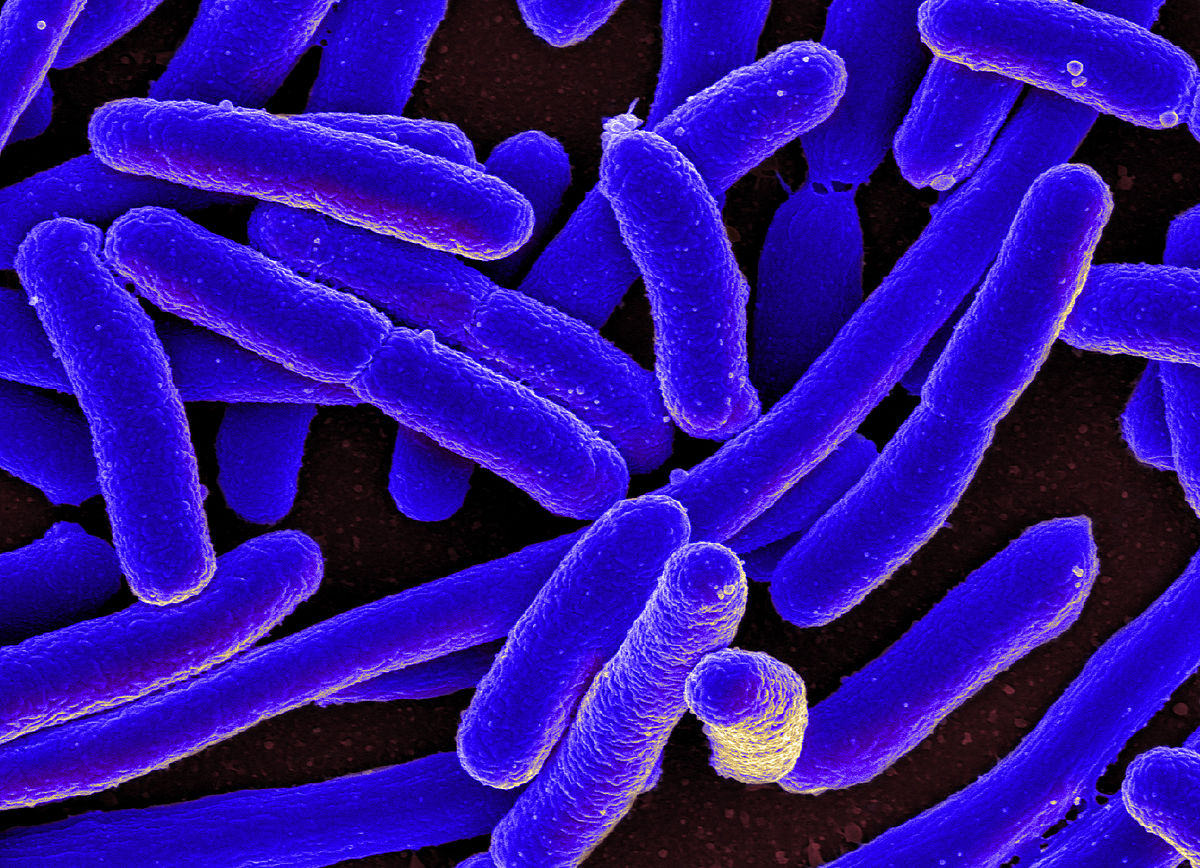 E._coli_Bacteria_16578744517